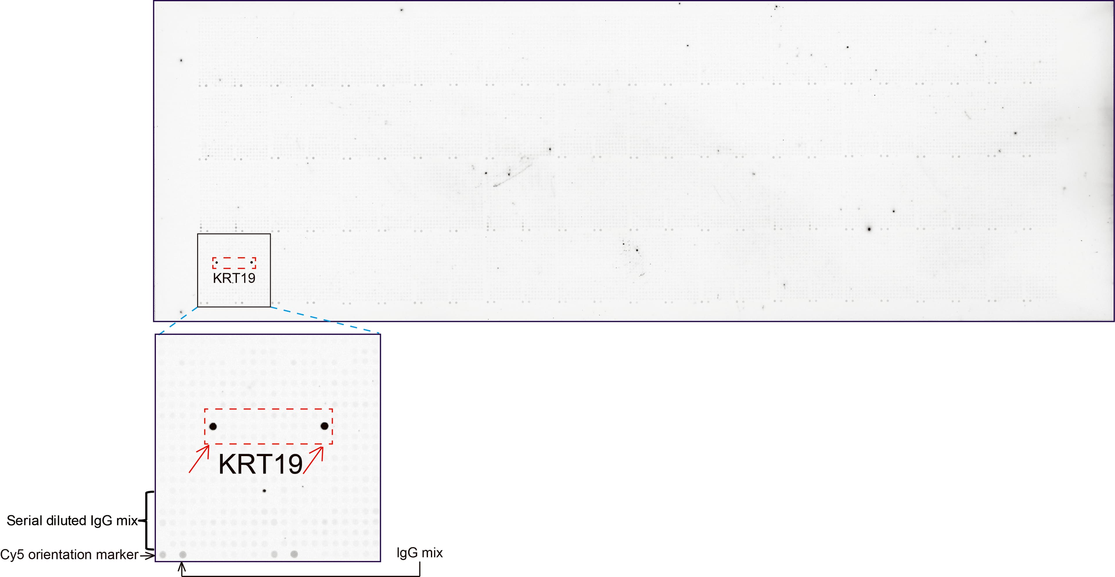 KRT19 / CK19 / Cytokeratin 19 Antibody (aa240-390, clone UMAB187, Carrier-free)