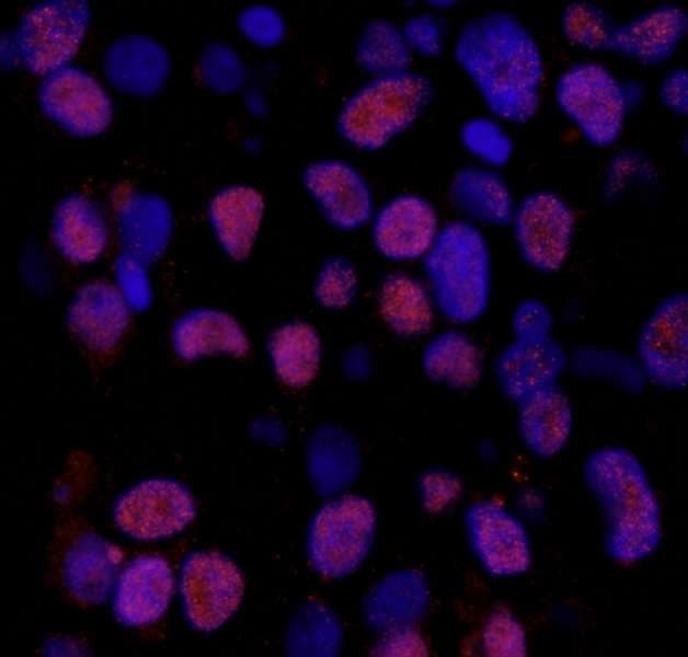 Polyclonal Rabbit anti-Human XRCC1 Antibody (phospho-Ser518 / phospho-Thr519/523, IHC, IF)