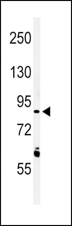 Polyclonal Rabbit anti-Human LRRN3 Antibody (aa107-134, WB)