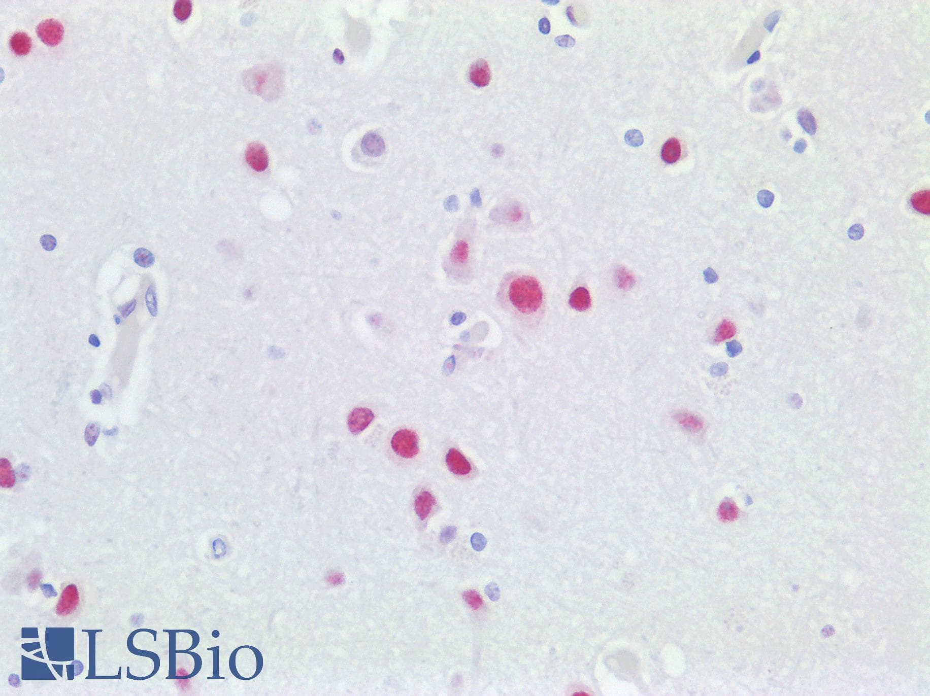 IHC-plus™ Polyclonal Rabbit anti-Human KHSRP / FBP2 Antibody (aa100-150, IHC)