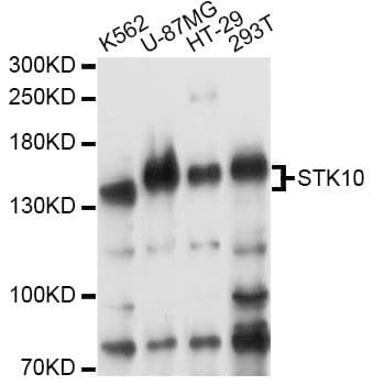 STK10 / LOK Antibody