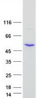 Human SMYD2 Protein (Recombinant Myc-DDK (Flag))