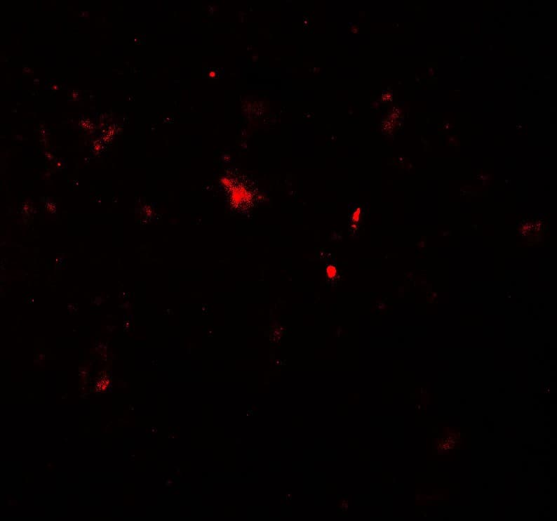 PARK2 / Parkin 2 Antibody