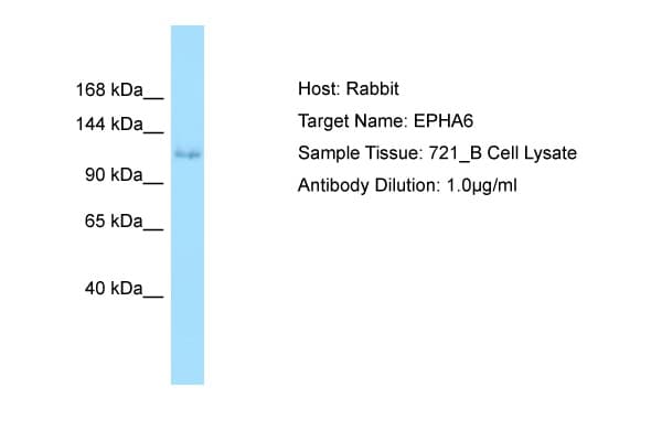 Polyclonal Rabbit anti-Human EPHA6 / EPH Receptor A6 Antibody (aa313-362, WB)