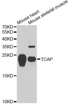 Polyclonal Rabbit anti-Human TCAP / Telethonin Antibody (IF, WB)