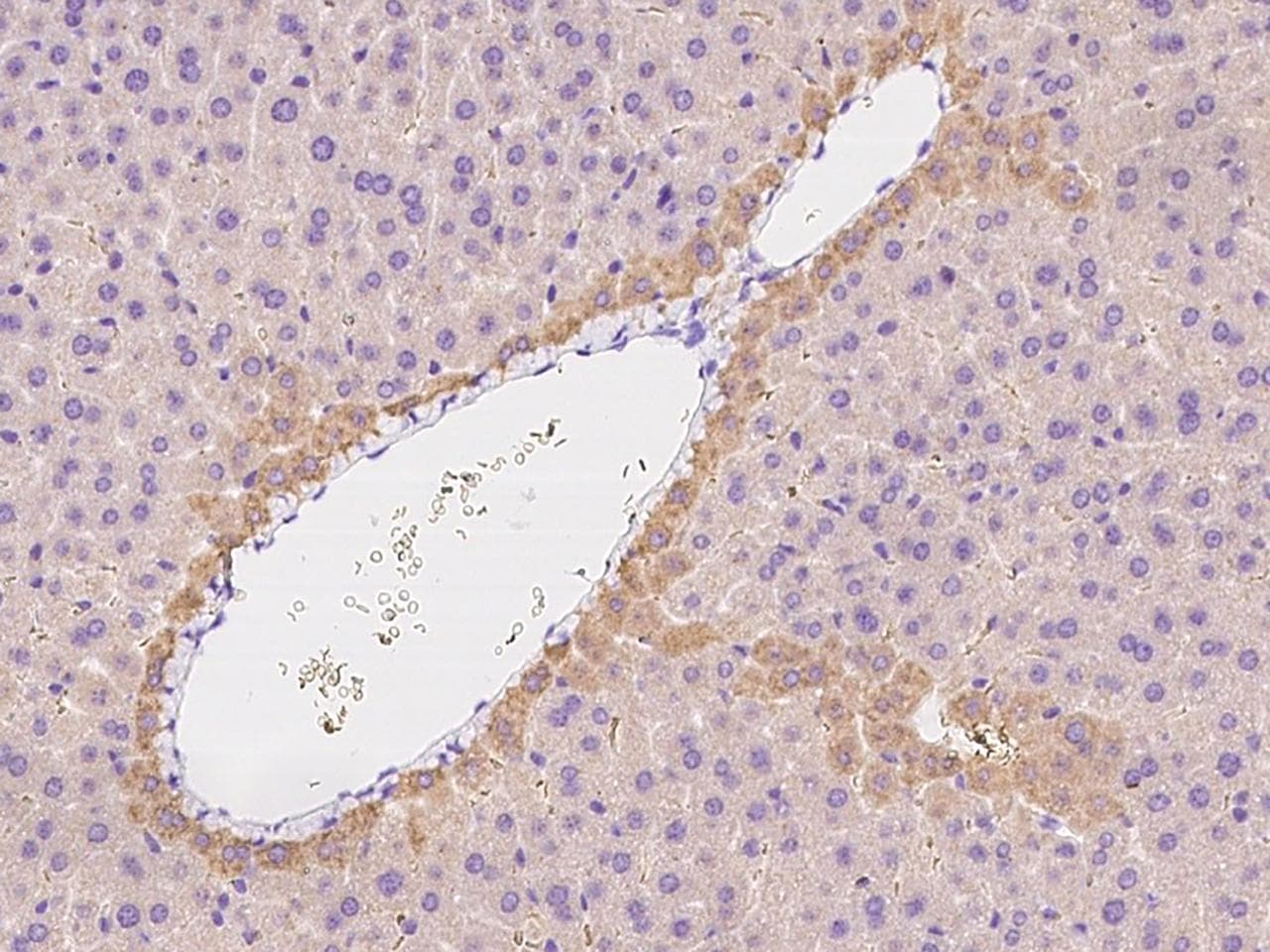 ENPP2 / Autotaxin Antibody (Preservative Free)