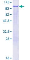 Human Epsin 1 / EPN1 Protein (Recombinant GST)