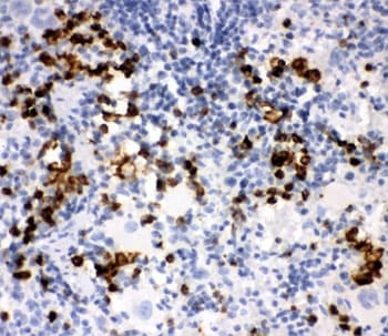 MPO / Myeloperoxidase Antibody (aa406-745)
