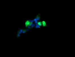 MAP2K3 / MEK3 / MKK3 Antibody (clone OTI4B3)