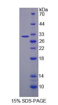 Human UCK2 Protein (Recombinant His-S)