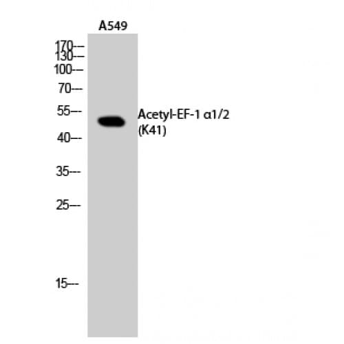 EEF1A1 + EEF1A2 Antibody (acetylation site of K41.)
