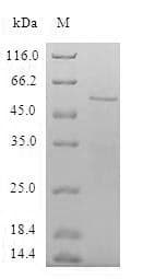 Human SPIN / SPIN1 Protein (Recombinant GST, N-terminus)