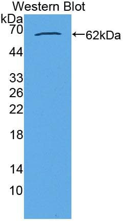AGK Antibody (aa15-300, PE)
