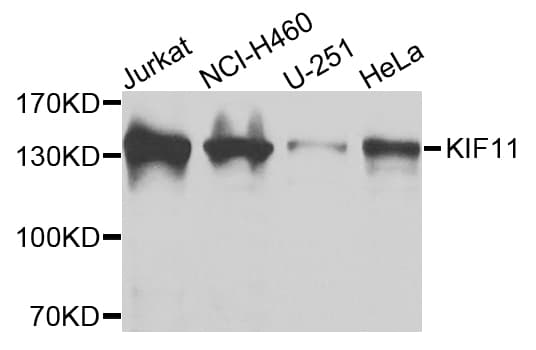 KIF11 / EG5 Antibody
