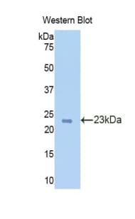 TPO / Thyroid Peroxidase Antibody (aa107-276, Cy3)