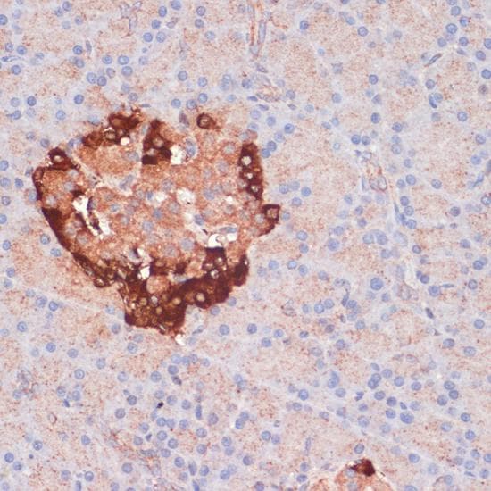 Polyclonal Rabbit anti-Human APG5 / ATG5 Antibody (IHC)