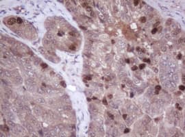 MKI67 / Ki67 Antibody (clone OTI3B8)
