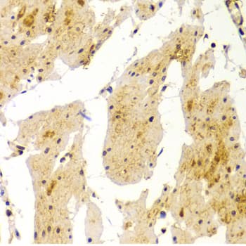 Polyclonal Rabbit anti-Human MVP / VAULT1 Antibody (IHC, WB)