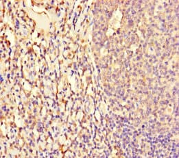 Polyclonal Rabbit anti-Human NF1A / NFIX Antibody