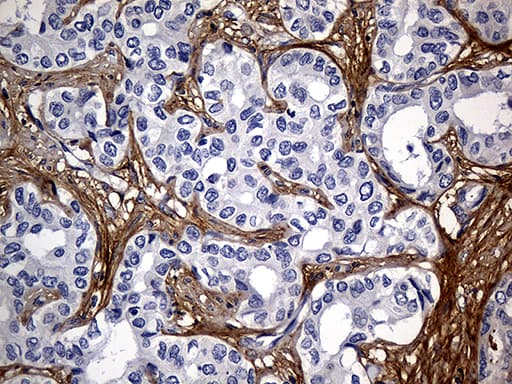 TGFBI Antibody (aa405-683, clone OTI9A11)