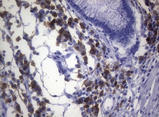 Monoclonal Mouse anti-Human CD38 Antibody (clone OTI1C9, aa43-300, IHC, WB)
