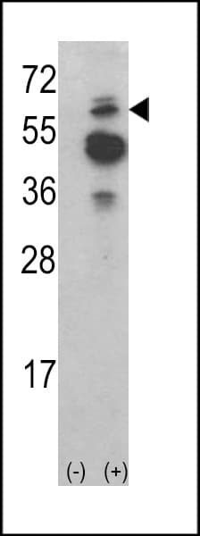 TNK2 / ACK1 Antibody (aa10-39)