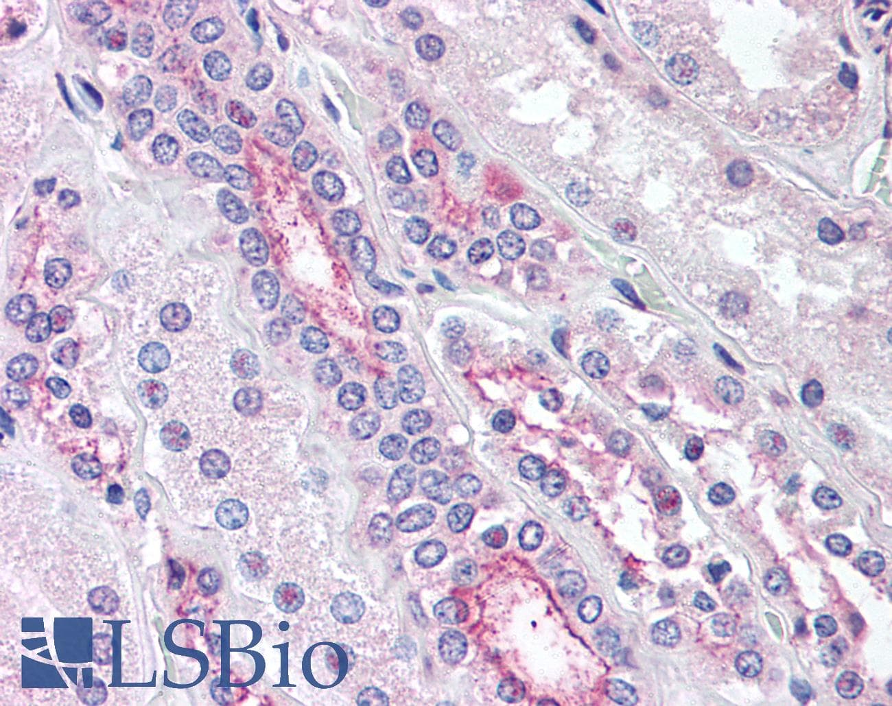 IHC-plus™ KCNE3 Antibody (Internal)