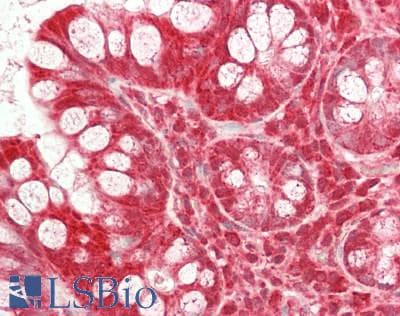 IHC-plus™ CYCS / Cytochrome c Antibody (aa2-105)