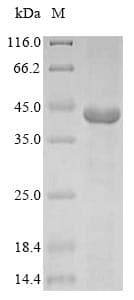Bovine GNAT2 Protein (Recombinant 6His, N-terminus)