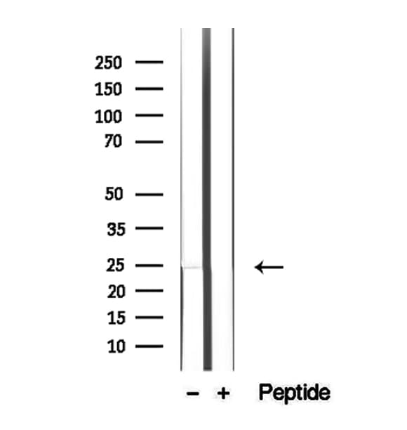 LAPTM4B Antibody