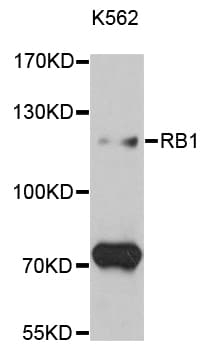 RB1 / Retinoblastoma / RB Antibody