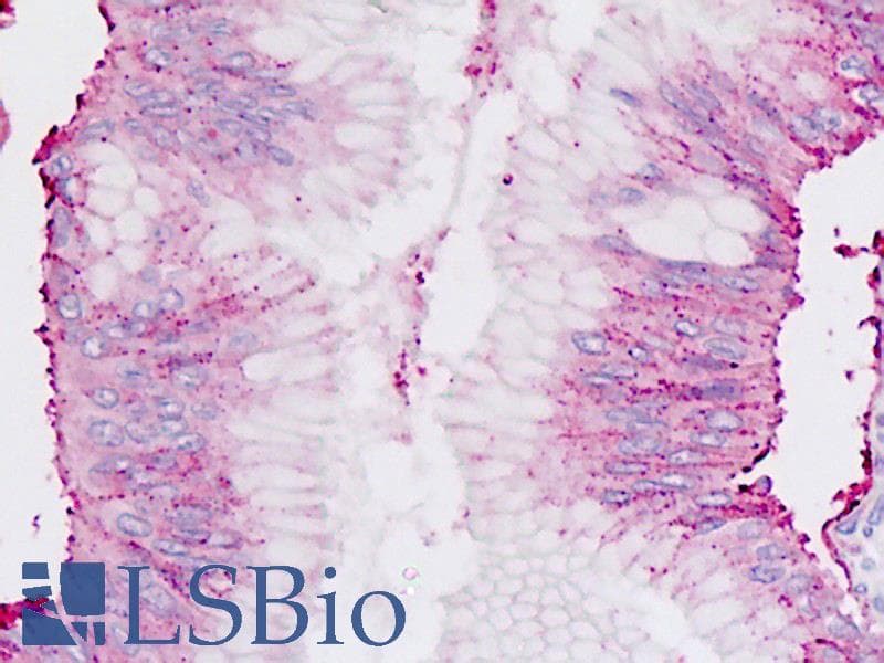 IHC-plus™ Chordin Antibody (aa926-955)