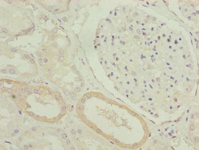 ZDHHC12 Antibody