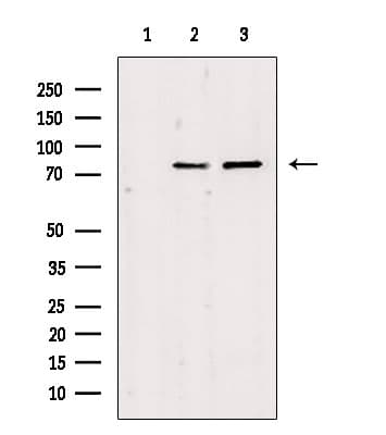 Polyclonal Rabbit anti-Human MAPK8IP2 / JIP2 Antibody (IHC, IF, WB)