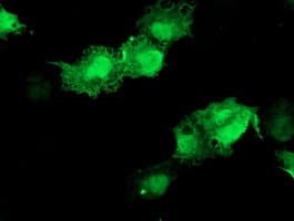 AKT1 Antibody (clone OTI4G4)
