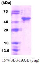 Human SIRT6 / Sirtuin 6 Protein (Recombinant His)