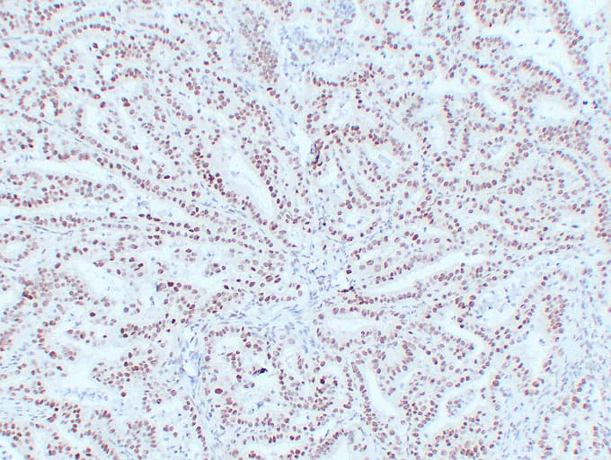 Monoclonal Mouse anti-Human MLH1 Antibody (clone ABT-MLH1, IHC, WB)