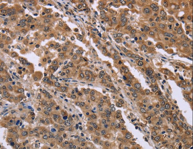 FAM3B Antibody