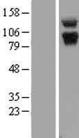 ABR Protein (Over-Expression Lysate Myc-DDK (Flag))