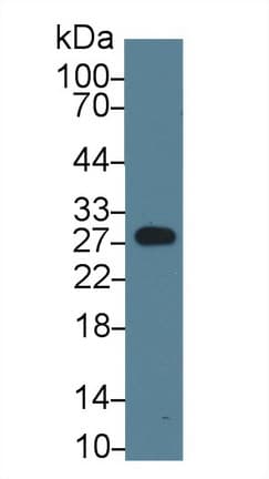 MBL2 / Mannose Binding Protein Antibody (aa19-244)