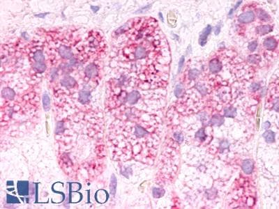 PathPlus™ Polyclonal Rabbit anti-Human GPR182 / ADMR Antibody (Cytoplasmic Domain, IHC)