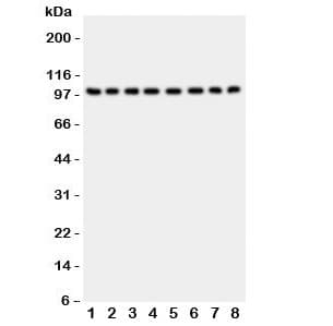 Polyclonal Rabbit anti-Human MME / CD10 Antibody (aa52-750, IHC, WB)