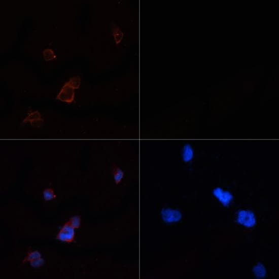 Acetyl-CoA Carboxylase / ACC Antibody