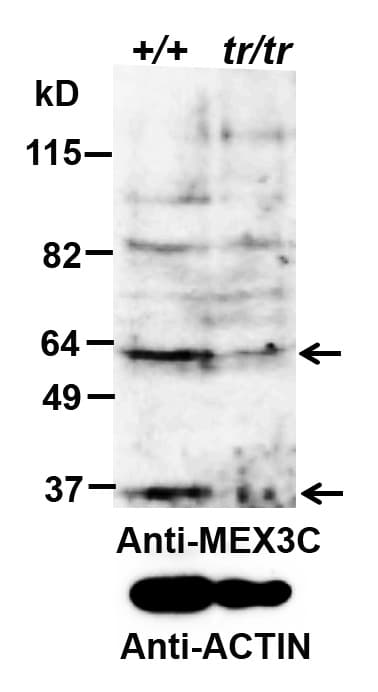 IHC-plus™ MEX3C Antibody (aa541-554)
