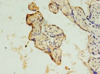 DRC7 / CCDC135 Antibody