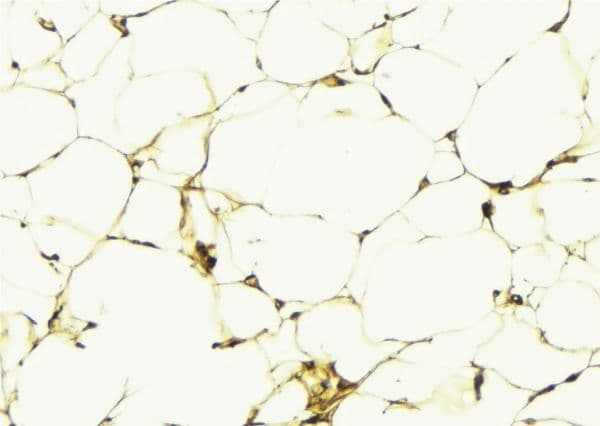LPAR1 / LPA1 / EDG2 Antibody