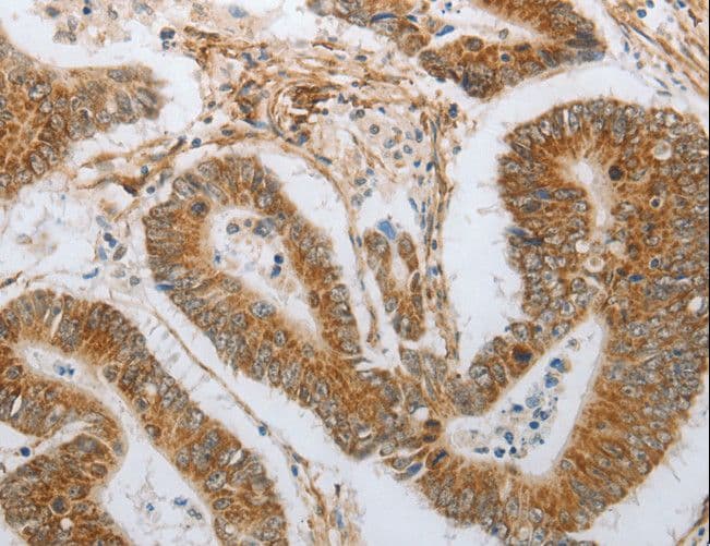 NEUROG1 / NGN1 / Neurogenin 1 Antibody