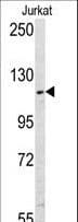 Polyclonal Rabbit anti-Human USP11 Antibody (aa279-308, IHC, WB)