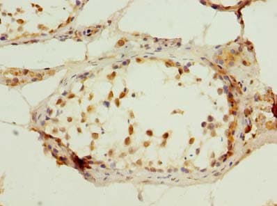 Polyclonal Rabbit anti-Human C7orf61 Antibody (IHC)