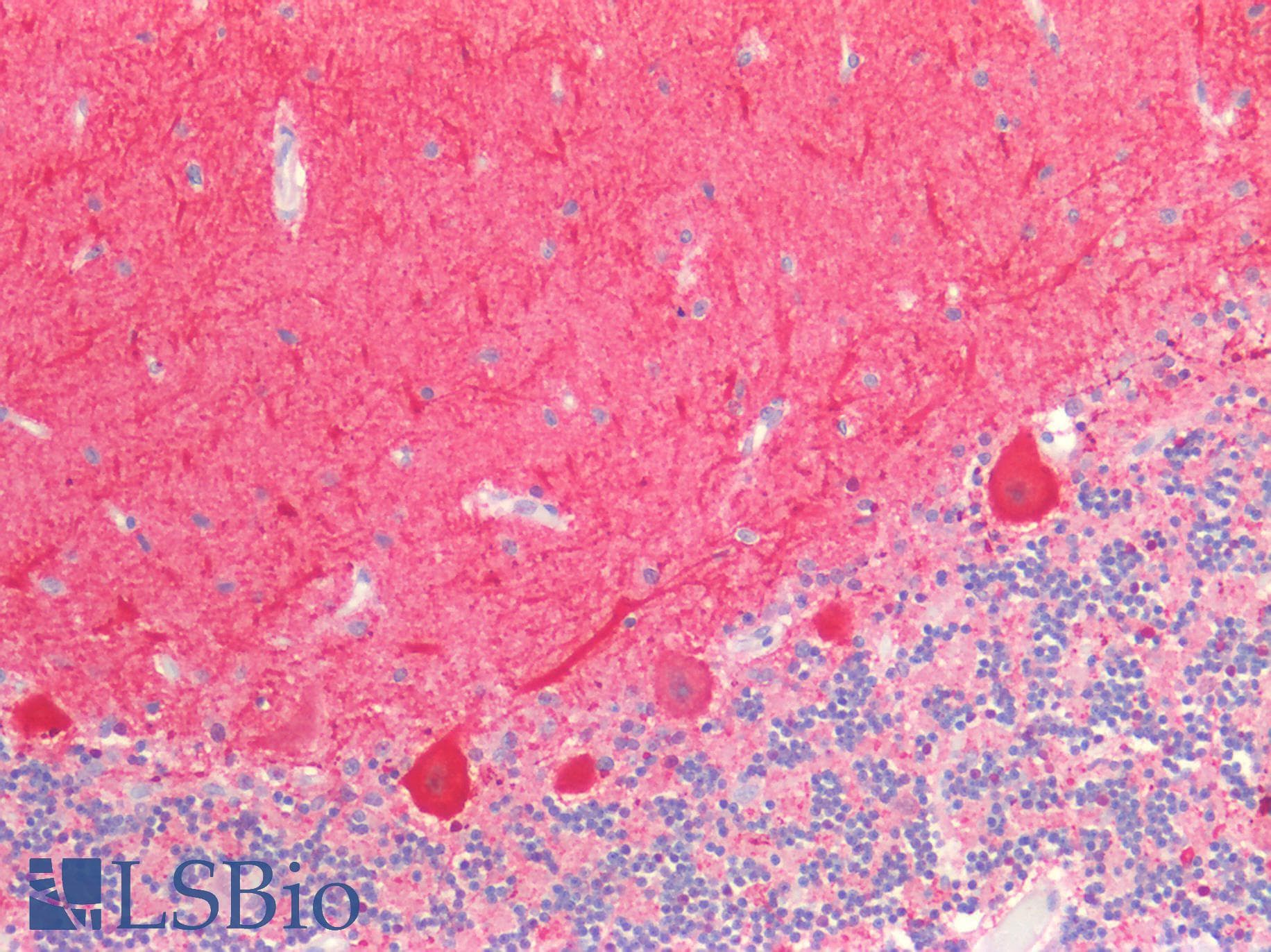 IHC-plus™ GRIN2A / NMDAR2A / NR2A Antibody
